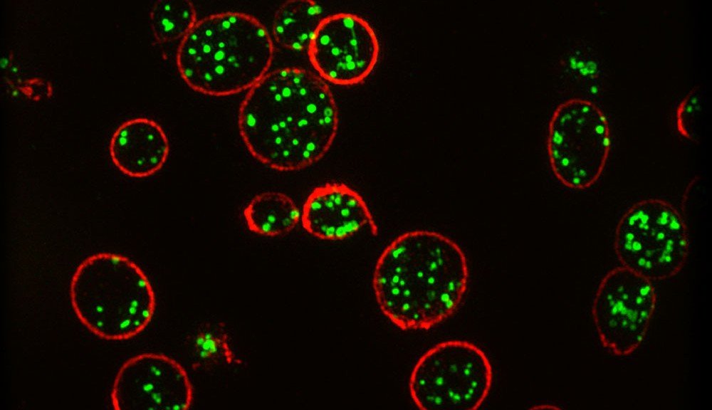 SIM image of platelets. Professor Dan Cutler, UCL