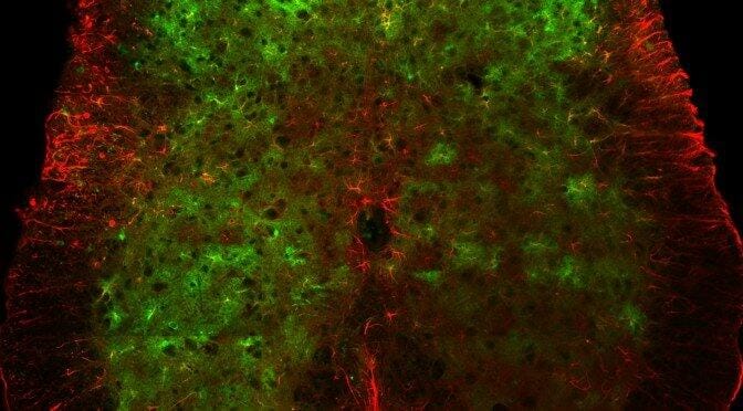 astrocytes